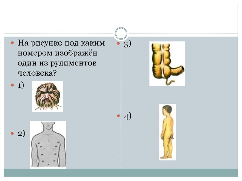На рисунке под каким номером изображён один из рудиментов человека? 1)   